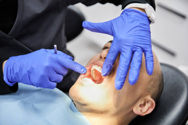 Best Broken Tooth Emergency  in Croswell, MI